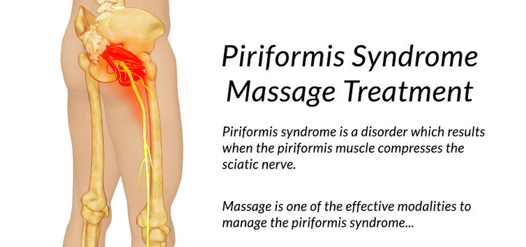 Massage For Piriformis Syndrome Treatment Vrogue Co