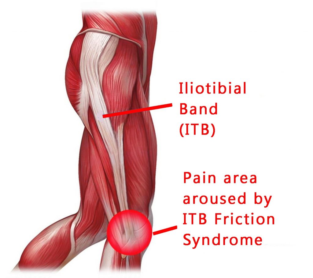 Coming Back from an Injury - Arduua